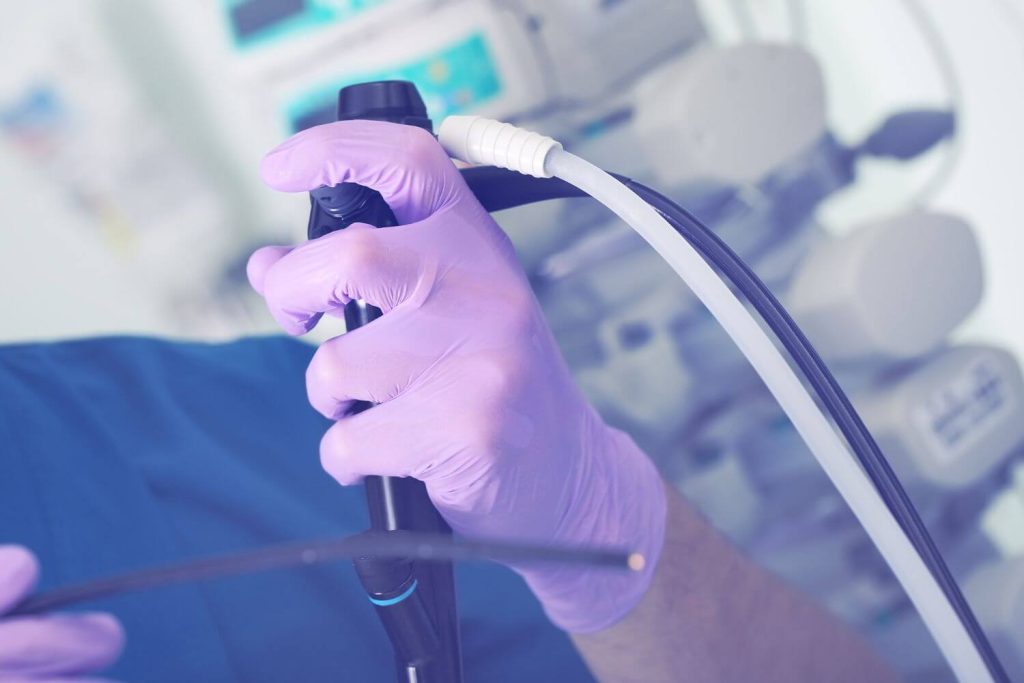 endoscopia para cirugia bariatrica en CD Juarez