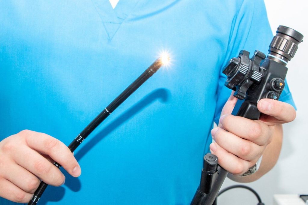 imagen destacada ¿Por qué debe de hacerse una endoscopia antes de la cirugía bariátrica