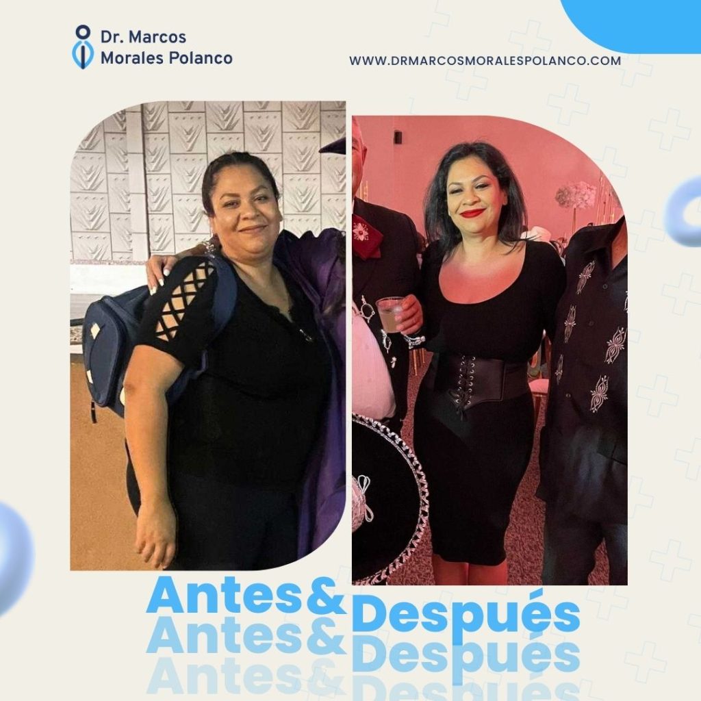 Antes y después 12