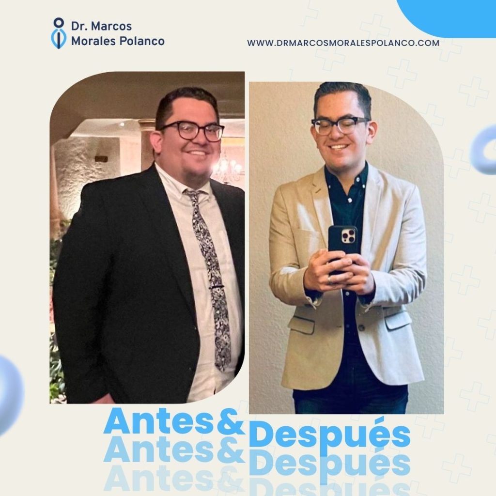 Antes y después 14