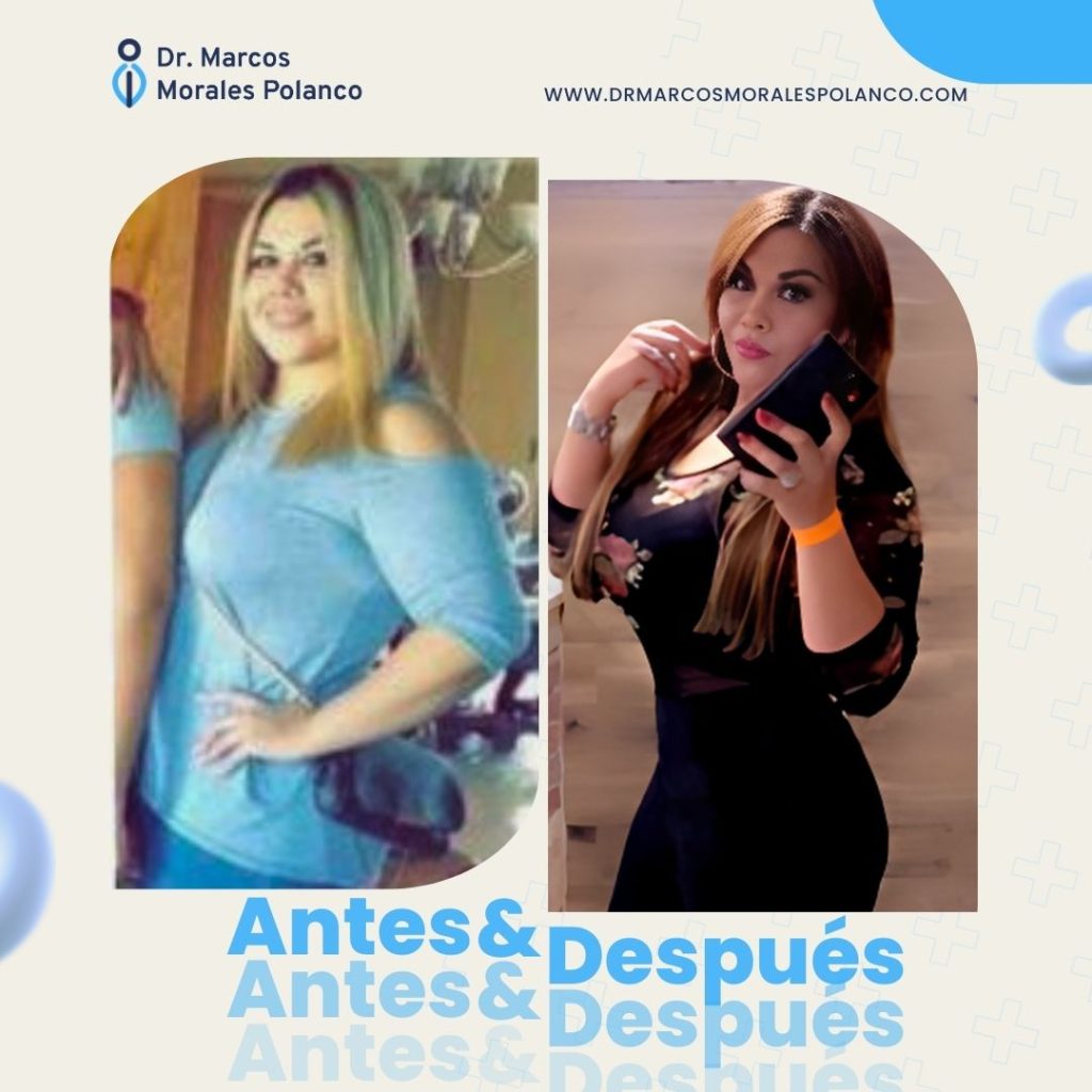 Antes y después 16