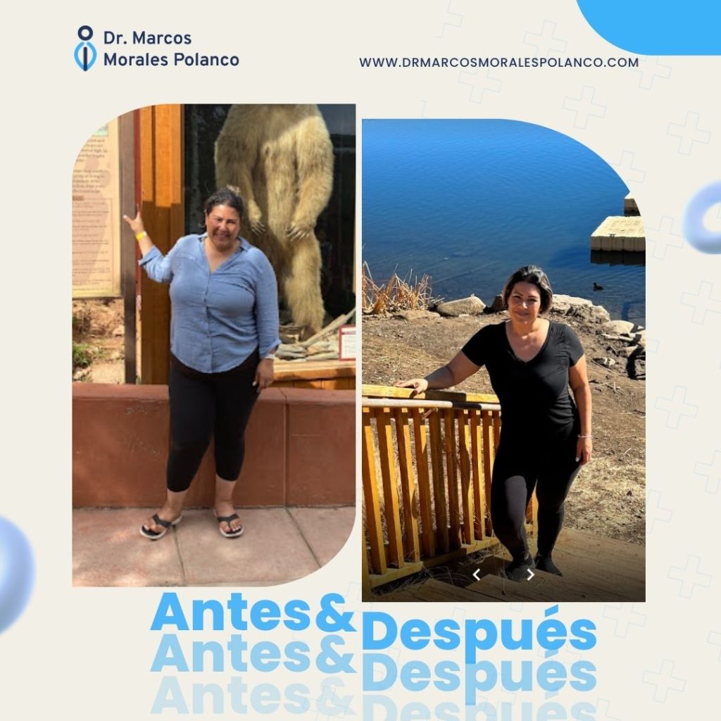 Antes y después 18