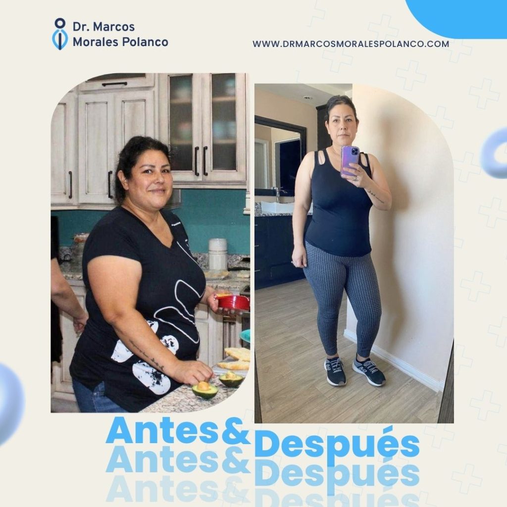 Antes y después 7